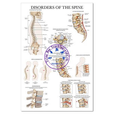 DISORDERS OF THE SPINE