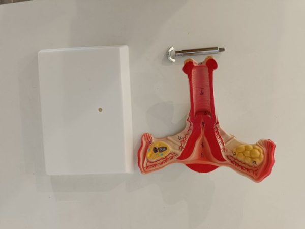 子宮模型 1:1 Uterus Ovary Model：圖片 2