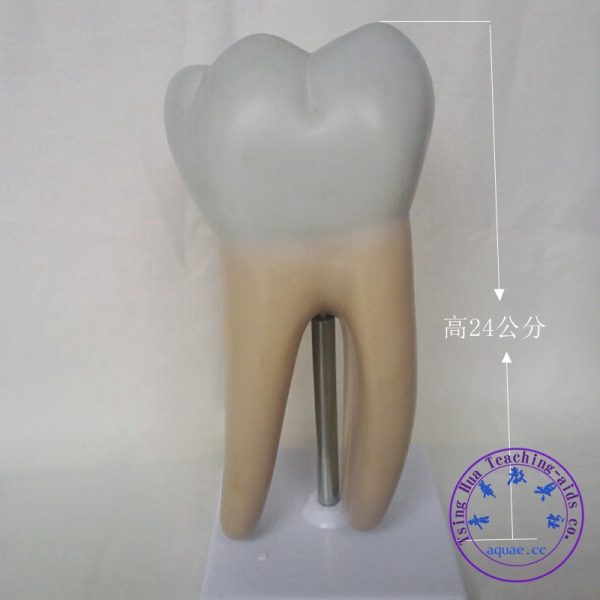 可半開蛀牙模型  Decayed Tooth Cross Section Display Model：圖片 2