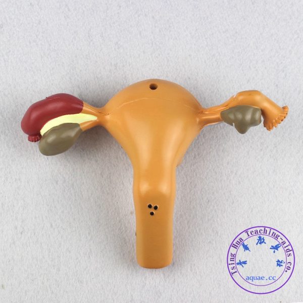 子宮病變模型 Sick Uterus Model：圖片 4